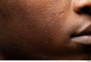  HD Face Skin Kavan cheek face lips mouth scar skin pores skin texture 0001.jpg